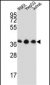 HNRPDL Antibody (Center)